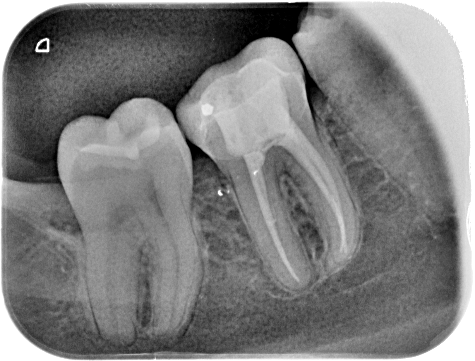 Endodoncia-01.JPG